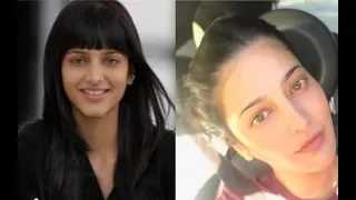 “What A Plastic Surgery!” Fans Troll Shruti Haasan’s 'Then' And 'Now' Picture