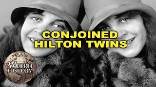 Conjoined Hilton Twins Will Break Your Heart