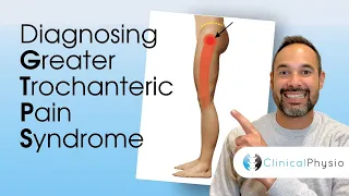 Diagnosing Greater Trochanteric Pain Syndrome | Expert Physio Explains