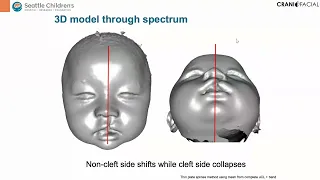 Nov. 27th. 2022 The International Craniofacial Chang Gung Webinar