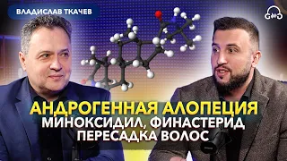 Трихолог Ткачев В.П. Выпадение волос, финастерид, миноксидил, пересадка волос, мезотерапия.