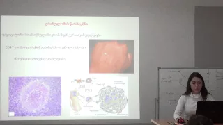 ქრონიკული გრანულომატოზი (Chronic granulomatosis)  თათა ავალიშვილი