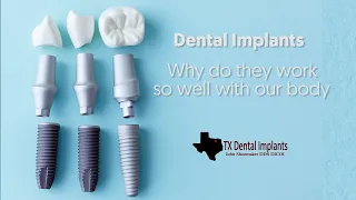 The Negative Effects of Not Replacing Missing Teeth with Dental Implants