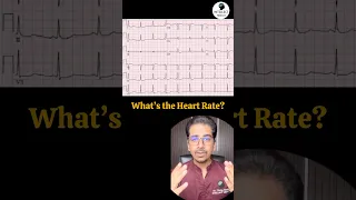 What’s the Heart rate? #cardiology #ecg #ekg