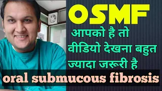 Oral Submucous Fibrosis(OSMF) in Hindi : Common Area,Clinical Features, Treatment & Home Remedies
