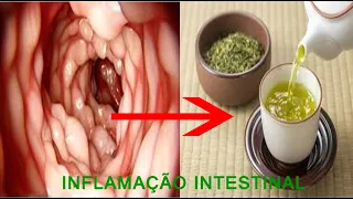 6 remédios caseiros para inflamação intestinal (Colite)!