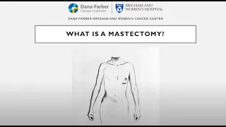 Mastectomy Surgery - Brigham and Women's Hospital