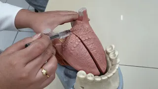 Tongue Model DeLasLlagas