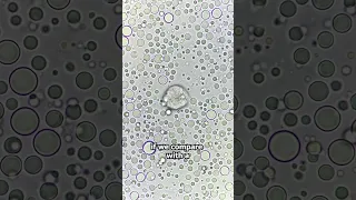 Raw Cows Milk VS Human Breast Milk under the microscope!