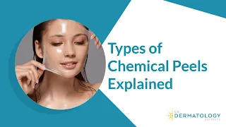 Types of Chemical Peels | Peels for Hyperpigmentation & Acne