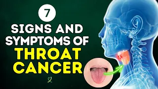 7 Signs and Symptoms of Throat Cancer