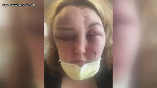 Woman shares domestic violence story in hopes of helping others