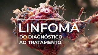 Explorando Opções de Tratamento para Linfoma