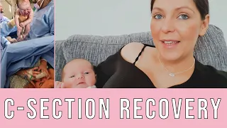 My Positive Elective C-Section Birth Experience & Recovery Story