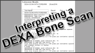 Interpreting a DEXA Bone Scan