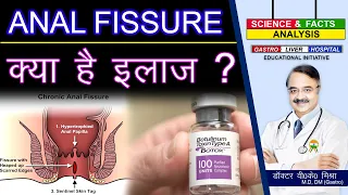 ANAL FISSURE क्या है इलाज ? || ANAL FISSURE. DIAGNOSIS AND TREATMENT