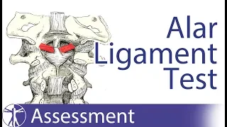 Alar Ligament Stress Test | Upper Cervical Spine Instability