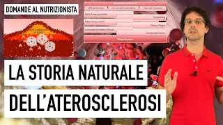 La storia naturale dell'aterosclerosi
