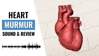 Heart Murmur Sounds | How to Identify a Heart Murmur |  3 Easy Steps to Identifying a Heart Murmur