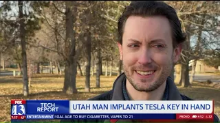 Utah man implants Tesla key in hand