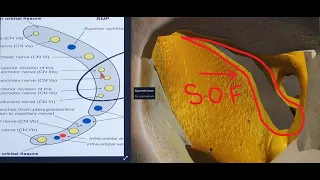 SUPERIOR ORBITAL FISSURE | 3D - ANATOMY | ORBITAL APEX & CONTENTS