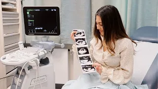 FIRST ULTRASOUND & HEARING BABYS' HEARTBEAT | 8 WEEKS PREGNANT