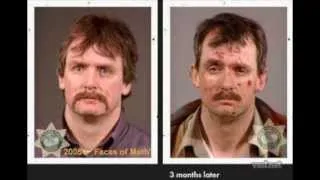 Faces of Meth - shocking before & after pictures