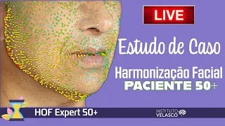 LIVE | Estudo de Caso Harmonização Facial Paciente 50+ | Aquecimento MasterClass HOF Expert 50+