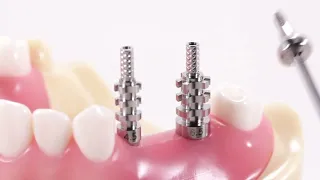 Dentium USA Bone-Level Implant Impression Step By Step Demonstration (Open Tray Technique)