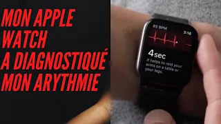 Mon Apple Watch a diagnostiqué ma tachycardie jonctionnelle