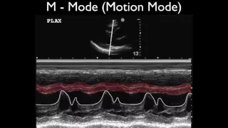 Ultrasound Physics Scanning Modes M Mode