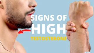 7 Physical Signs You Have High Testosterone Levels