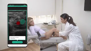 How ThinkSono AI Makes Ultrasound Imaging Quickly Accessible for Novices