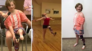 Rare Surgery Allows 12-Year-Old to Keep Dancing After Losing Leg to Bone Cancer