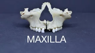 MAXILLA