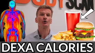 Calculate Calories to Lose Weight using DEXA Body Scan (UK)