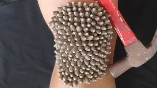 We Help Cleaning Million Big Ticks on Knee Man With Hammer That Work 100% #1190