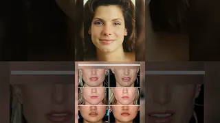 Did Sandra Bullock have Plastic Surgery?