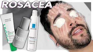 Dealing With & Managing Rosacea - IPL, Azelaic Acid, barrier Repair ✖  James Welsh