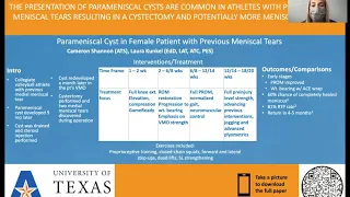 Parameniscal Cyst in Female Patient with Previous Meniscal Tears