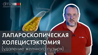 Холецистэктомия: единственный способ лечения желчнокаменной болезни и холецистита