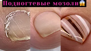 Как убрать подногтевые мозоли💅Секреты чистого педикюра😍Педикюр за 1,5 часа