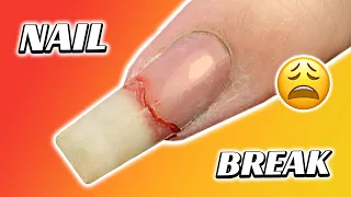 How to repair a broken nail | Nail break