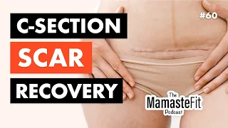 Episode 60: C-section Recovery & Scar Mobilization Tips