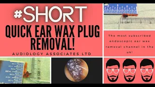 QUICK EAR WAX PLUG REMOVAL #SHORTS