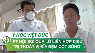 Phẫu thuật nội soi qua lỗ liên hợp điều trị thoát vị đĩa đệm cột sống thắt lưng | BV Việt Đức