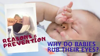 Why do babies rub their eyes?| Reasons|Prevention