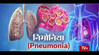 Ayushman Bhava:  निमोनिया | Pneumonia