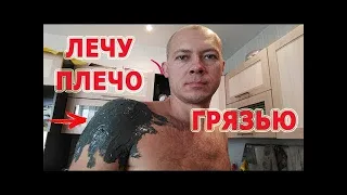 ★★ГРЯЗЕЛЕЧЕНИЕ. Как я лечу плечо грязью.