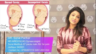 Short Cervix क्या होता है (बच्चे दानी का मुँह छोटा होना )